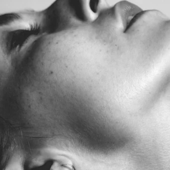 FDA попереджає: мікроголковий RF-ліфтинг може бути небезпечним