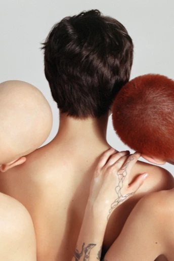 Гола правда: жінки, які втратили волосся, — про свій досвід