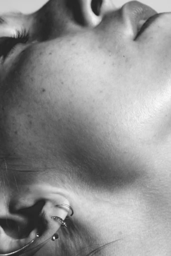 FDA попереджає: мікроголковий RF-ліфтинг може бути небезпечним