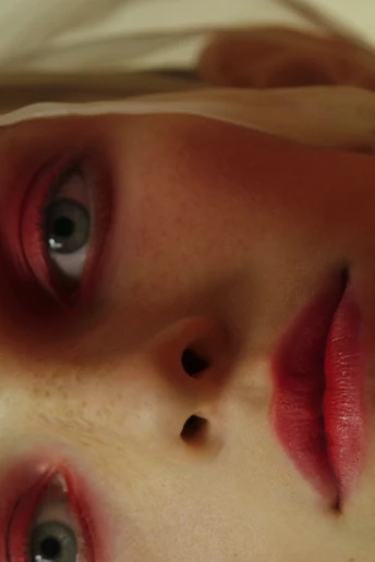 Як подолати почервоніння (судинні патології) на обличчі: процедура, яка справді працює