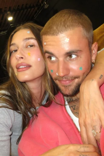 Патчі від акне: Гейлі та Джастін Бібери запускають б’юті-гіт для Coachella